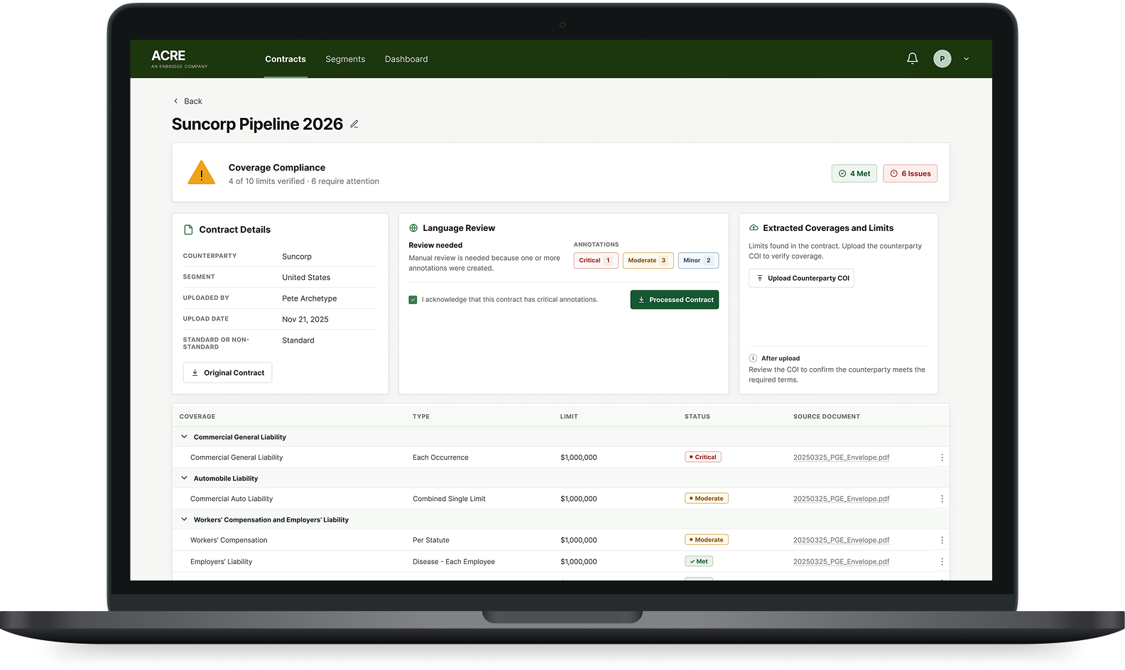 ACRE contract review product on a laptop